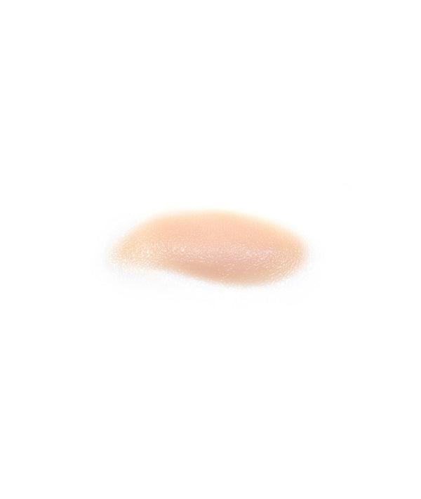 Left Eye Swollen Shut (upper)