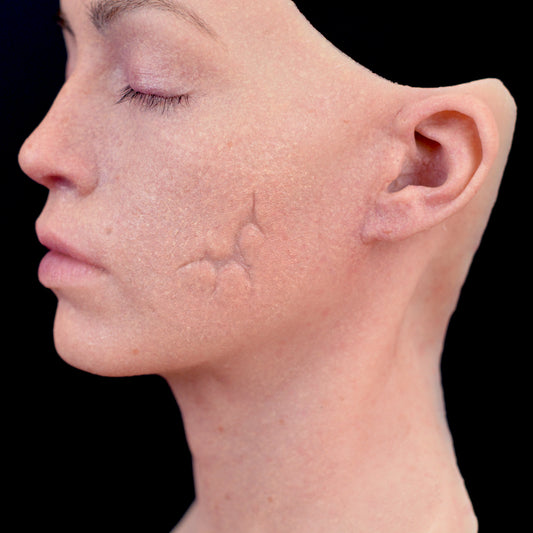Indentent Character Scar 2