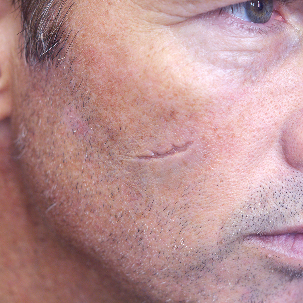 Sunken Scar 3