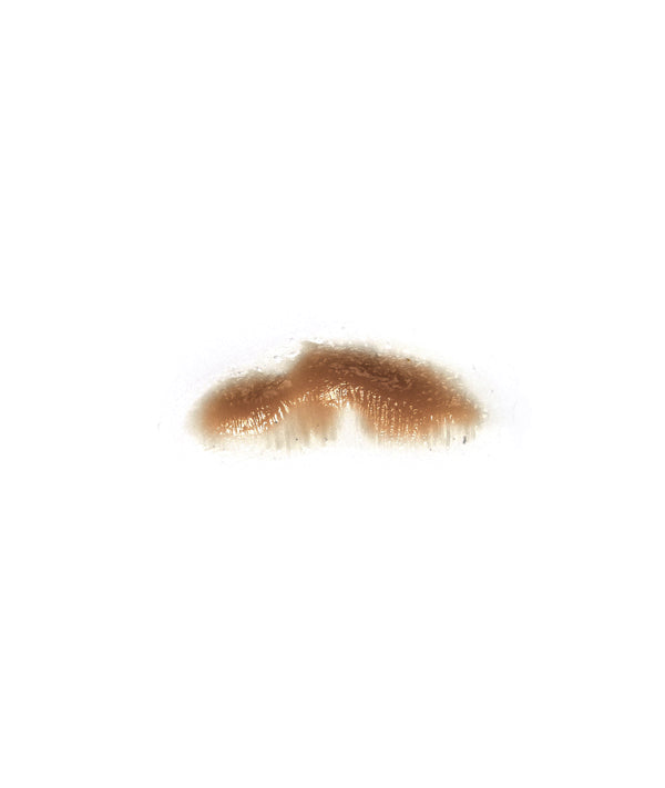 Swollen Right Upper lip