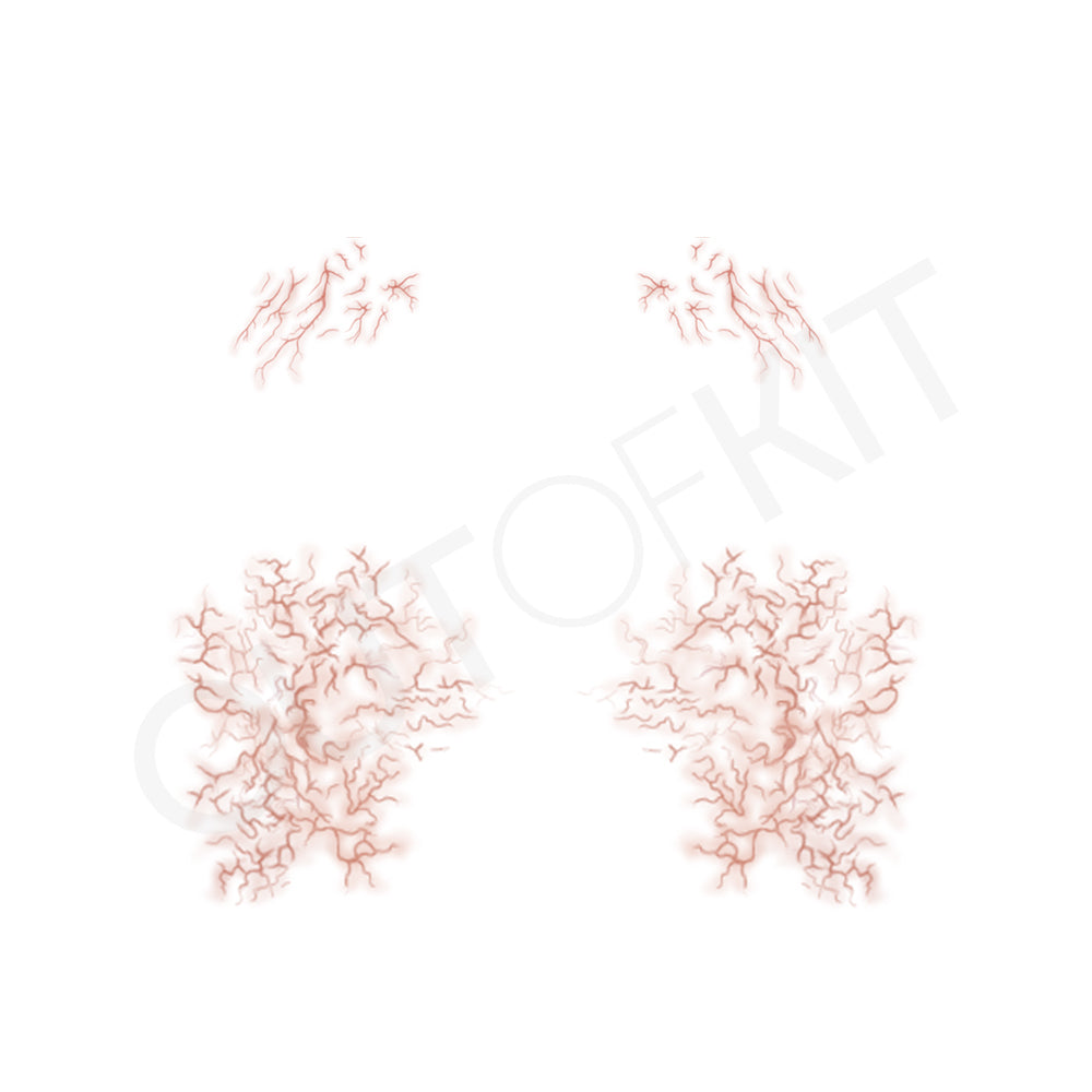 Blood Vessels