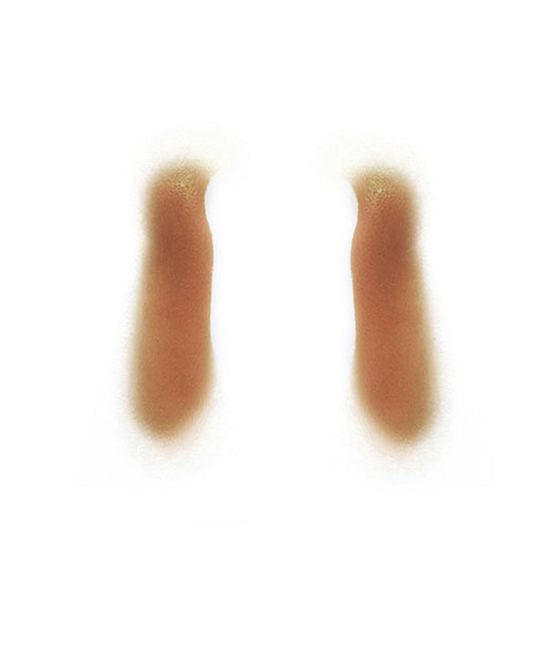 Male Nasolabial Folds 1