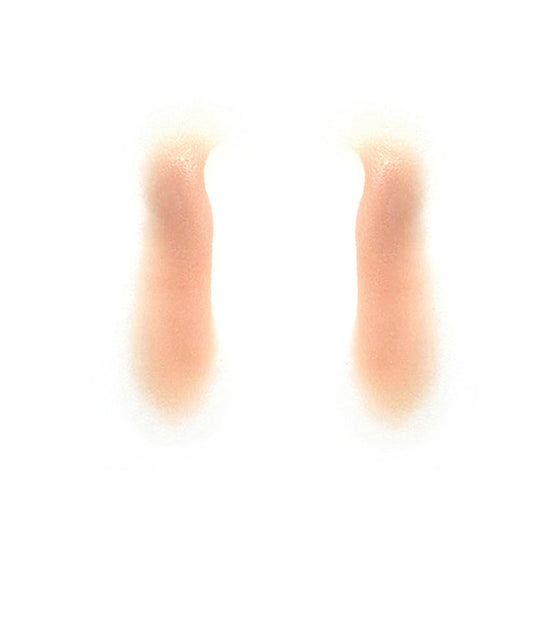 Male Nasolabial Folds 1