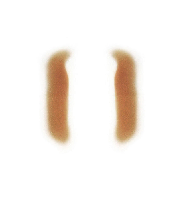 Female Nasolabial Folds 1