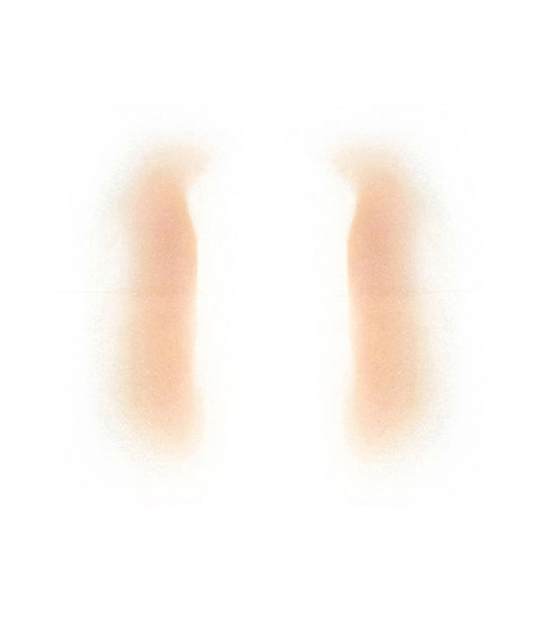 Female Nasolabial Folds 1
