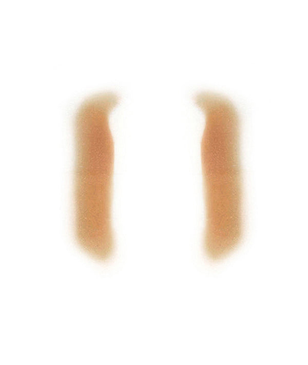 Female Nasolabial Folds 1