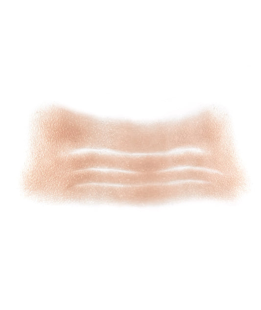 Male Old Age Forehead 1