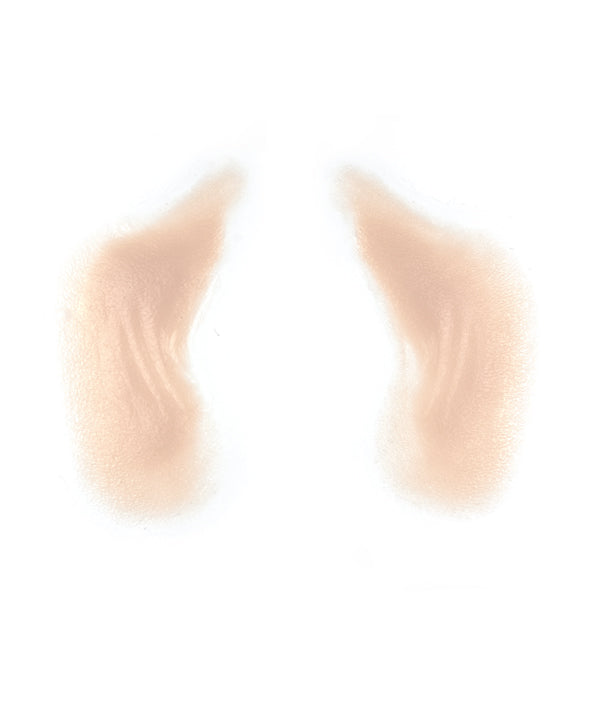 Female Nasolabial Folds with Jowls 4