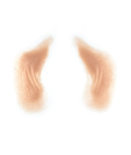 Female Nasolabial Folds with Jowls 4