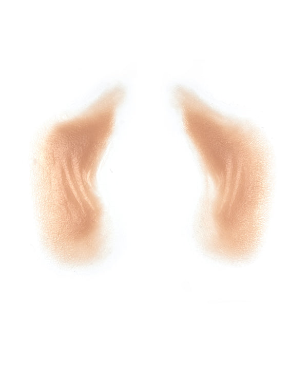 Female Nasolabial Folds with Jowls 4