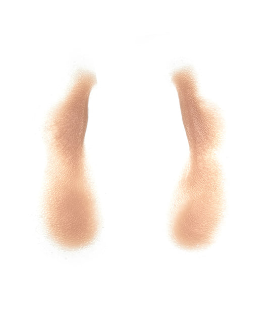 Male Nasolabial Folds and Jowls 8