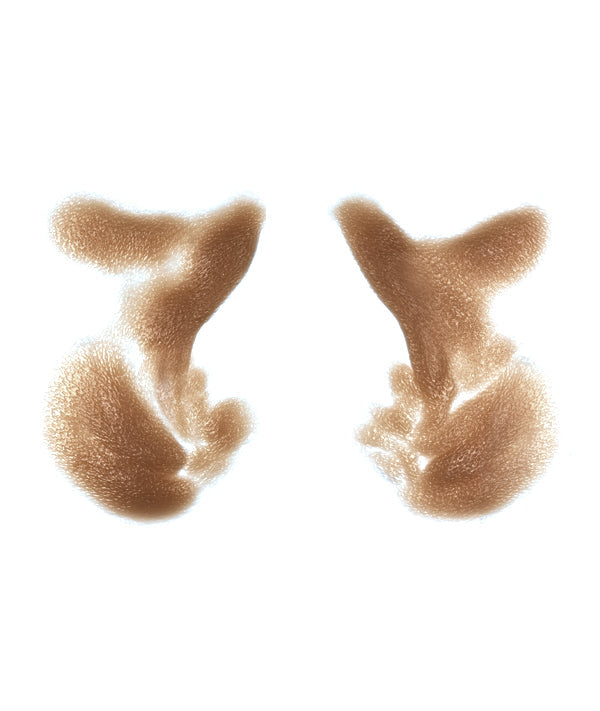 Male Nasolabial Folds and Jowls 12