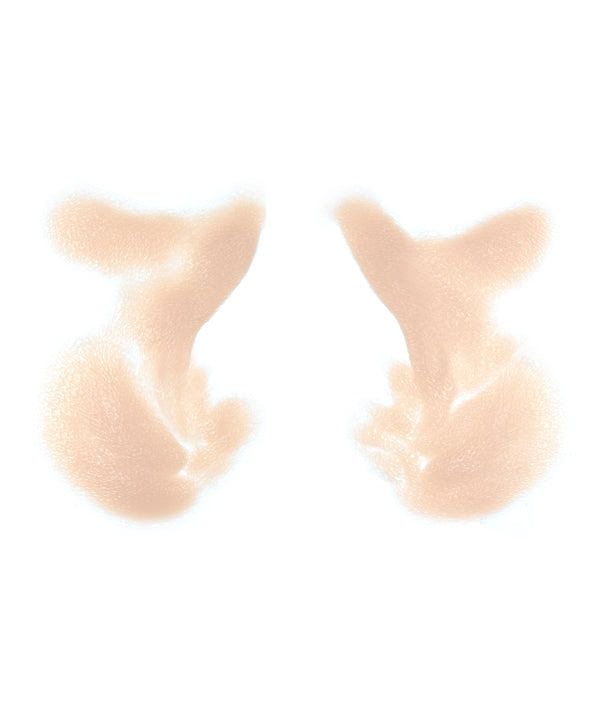 Male Nasolabial Folds and Jowls 12