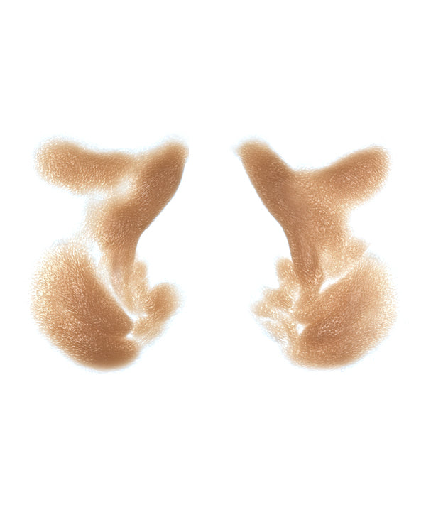 Male Nasolabial Folds and Jowls 12