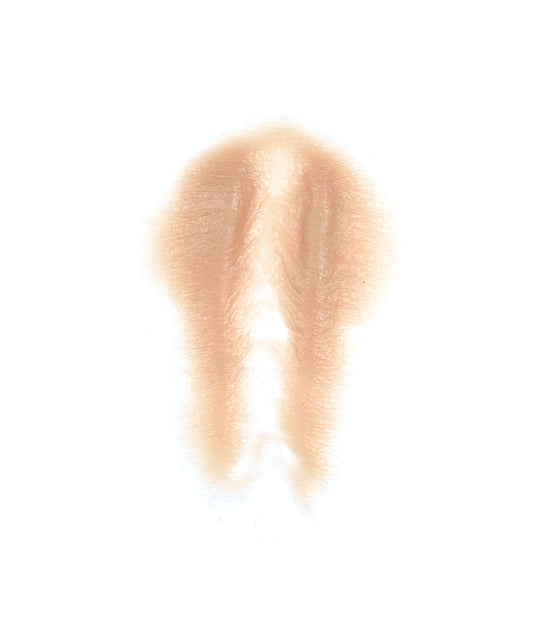 Female Neck Waddle 8