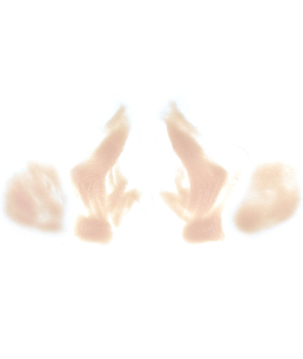 Female Nasolabial Folds with Jowls 7