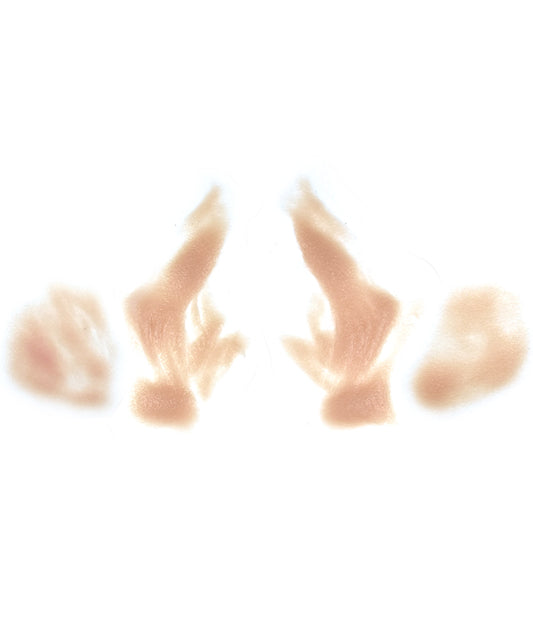 Female Nasolabial Folds with Jowls 7