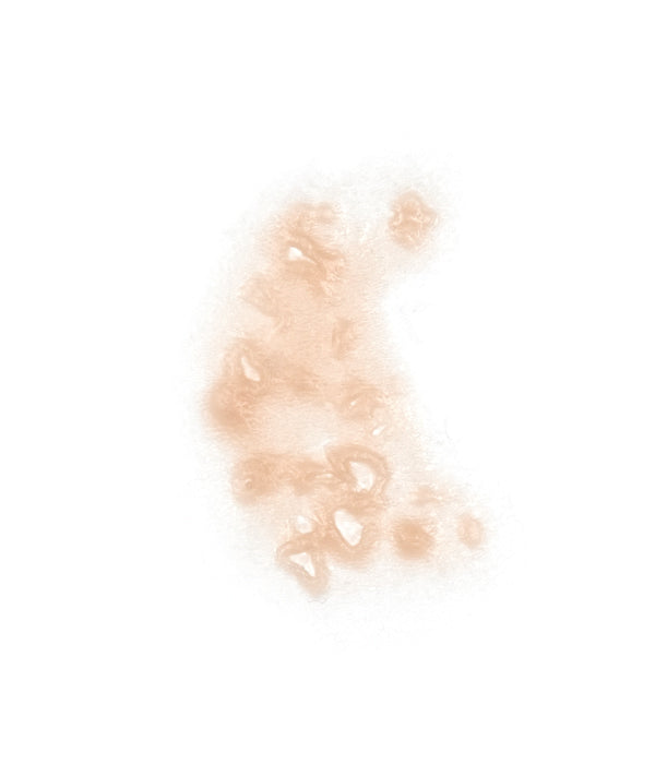 Skin Infection 5