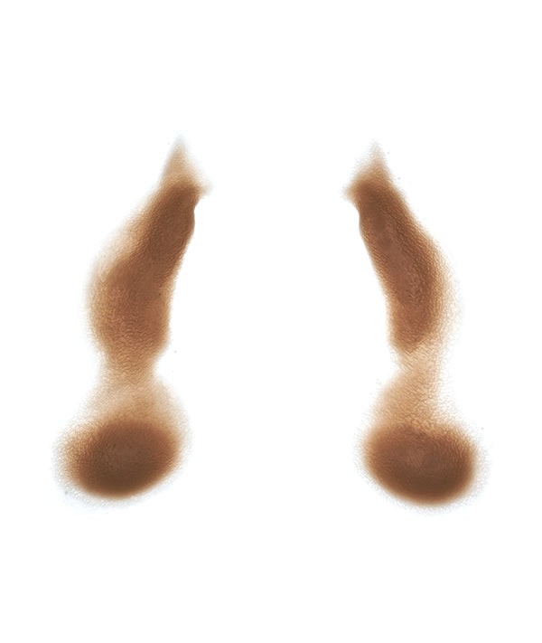 Female Nasolabial Folds with Jowls 8