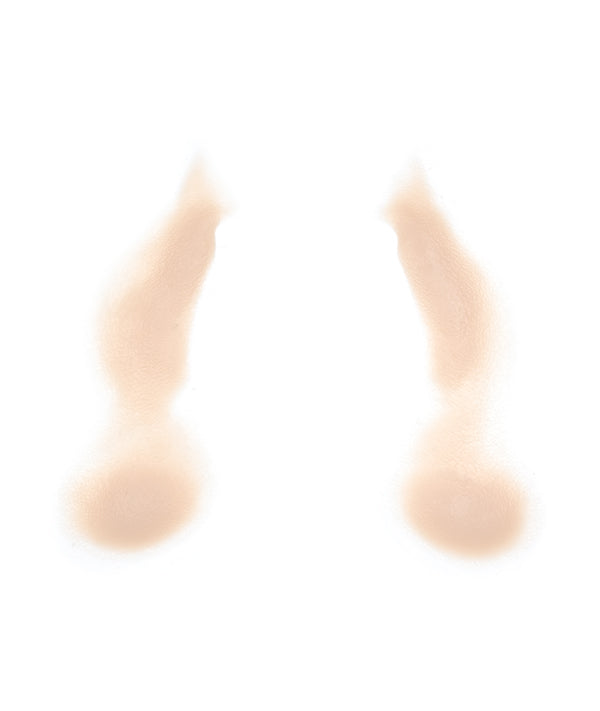 Female Nasolabial Folds with Jowls 8