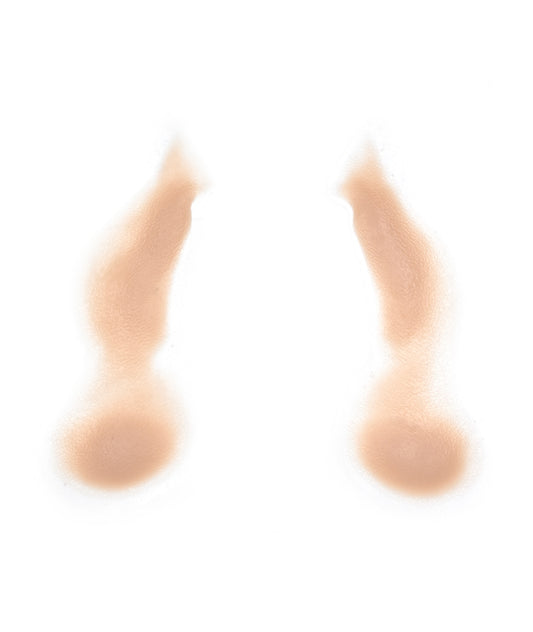 Female Nasolabial Folds with Jowls 8
