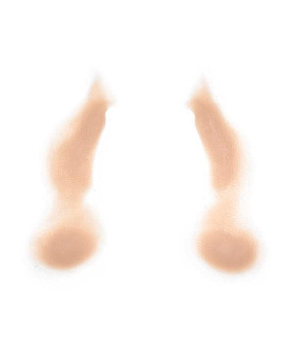 Female Nasolabial Folds with Jowls 8