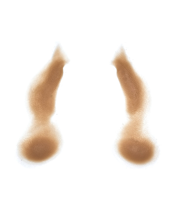 Female Nasolabial Folds with Jowls 8