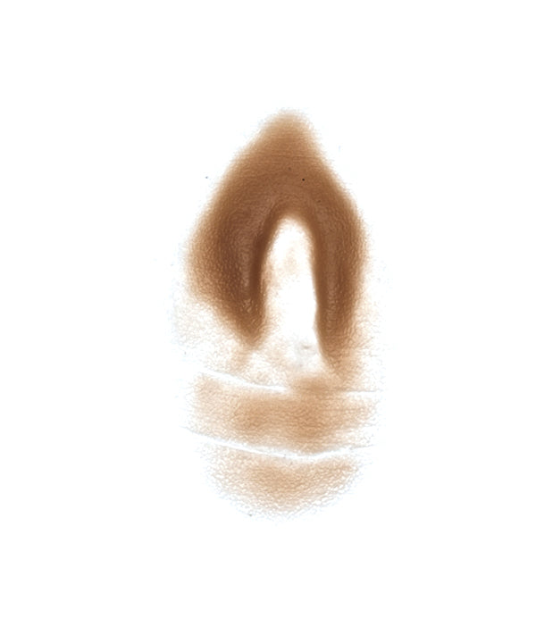 Female Neck Waddle 9