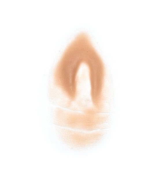 Female Neck Waddle 9