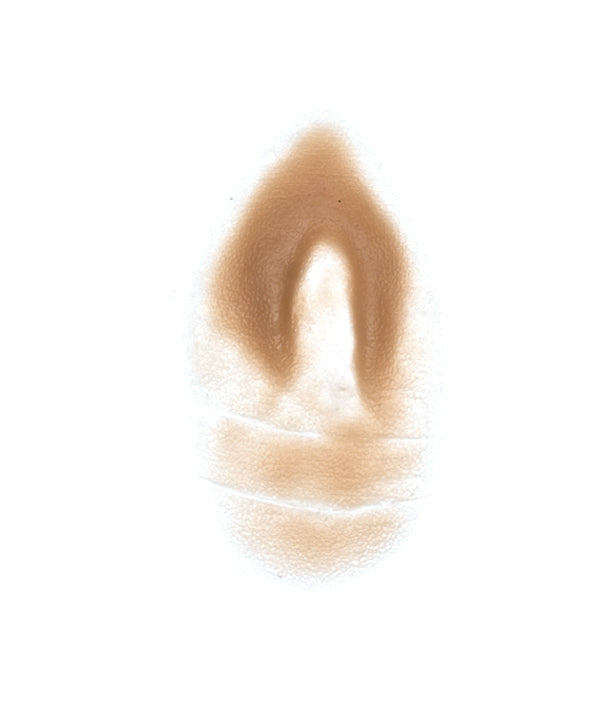 Female Neck Waddle 9