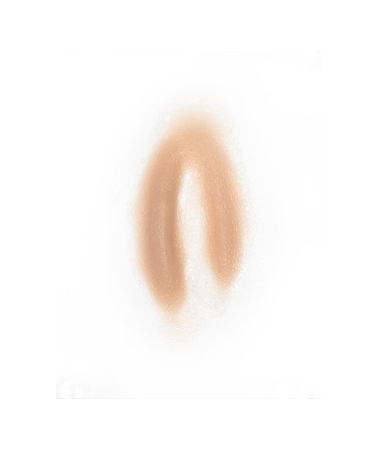 Female Neck Waddle 10