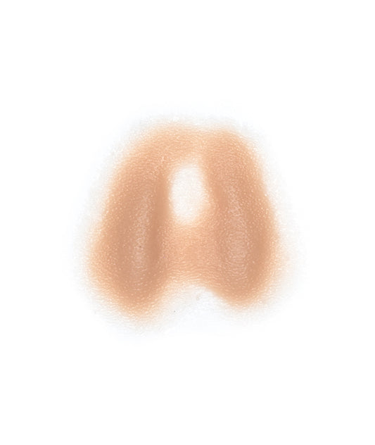 Male Neck Waddle 6