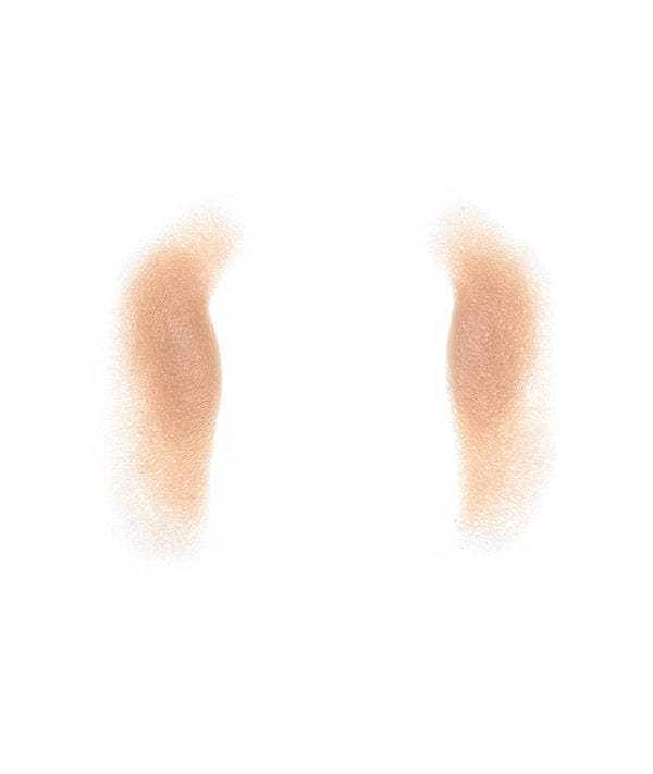 Male Nasolabial Folds 4