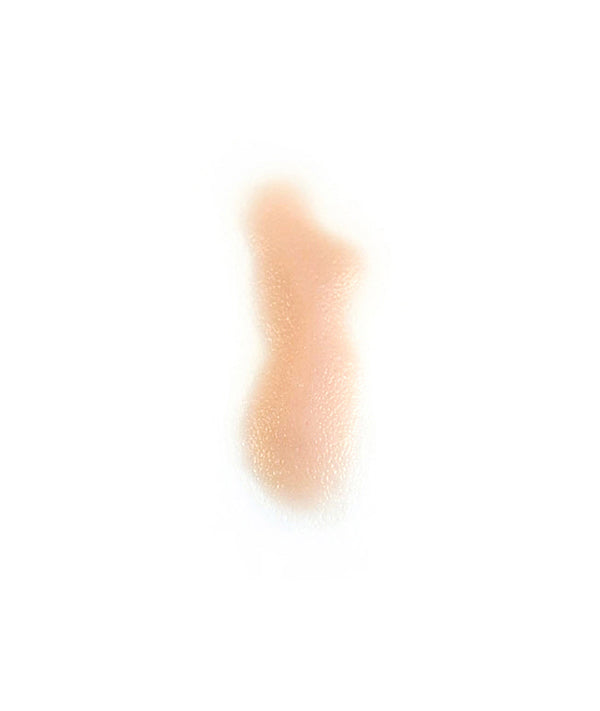 Swollen Right Nasolabial fold