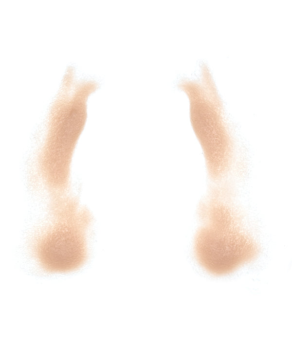 Female Nasolabial Folds with Jowls 9