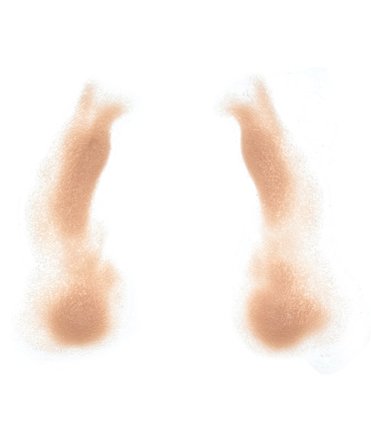 Female Nasolabial Folds with Jowls 9