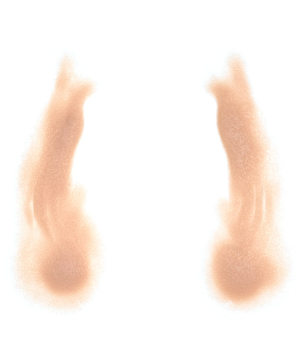 Female Nasolabial Folds with Jowls 10