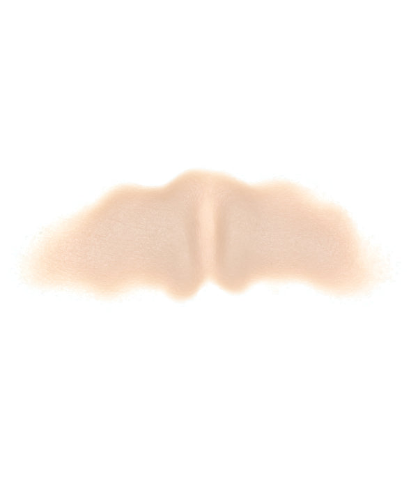 Female Neck Waddle 5