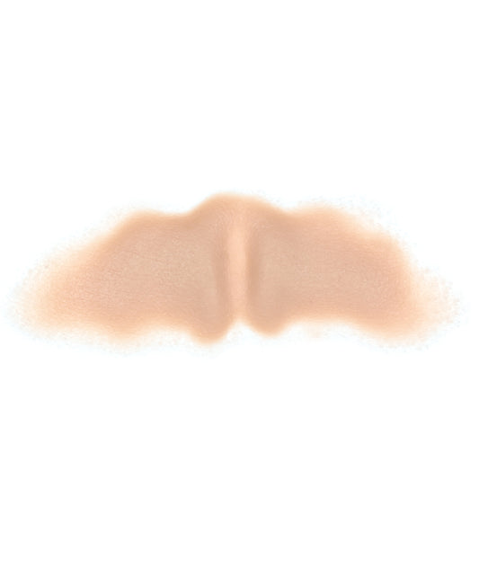 Female Neck Waddle 5