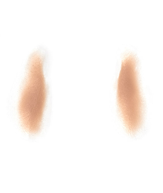 Female Nasolabial Folds 5