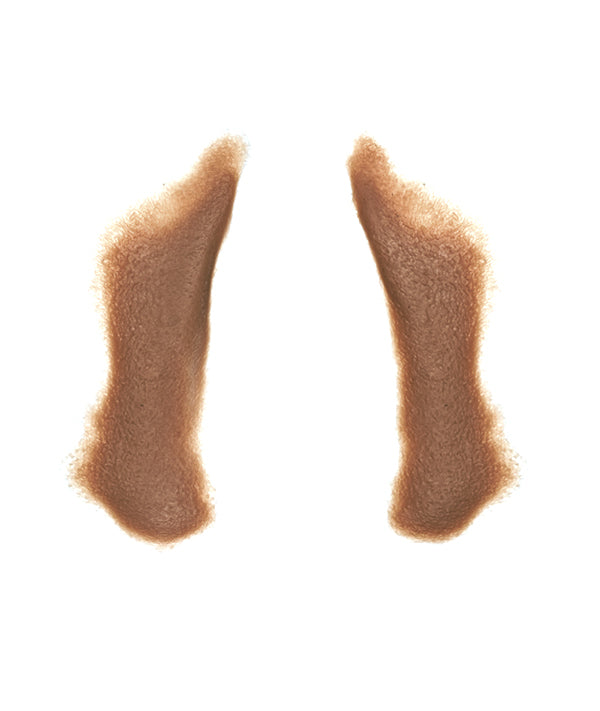 Male Nasolabial Folds 6