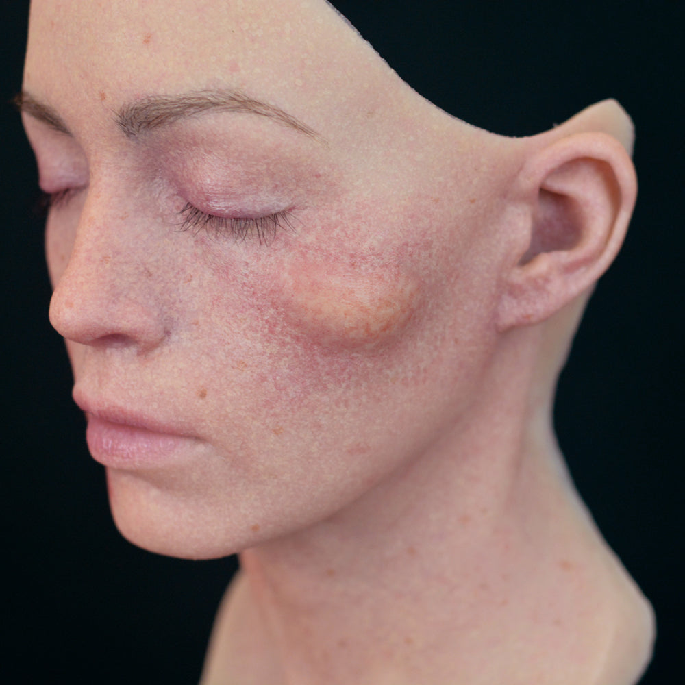Swollen Lump 3