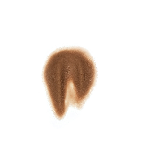 Female Neck Waddle 12