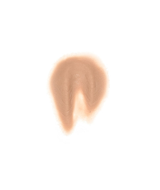 Female Neck Waddle 1