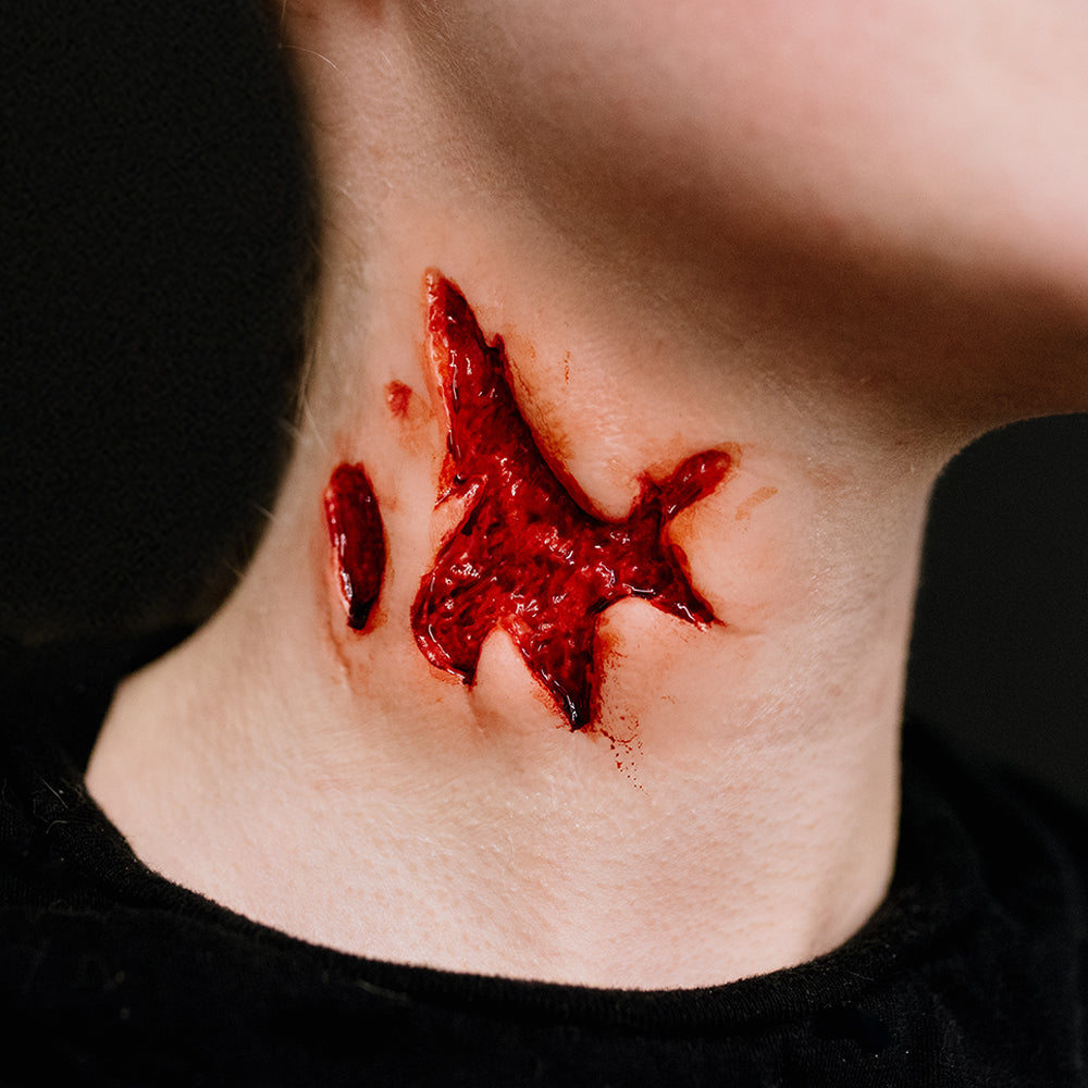 Bottle Neck Wound