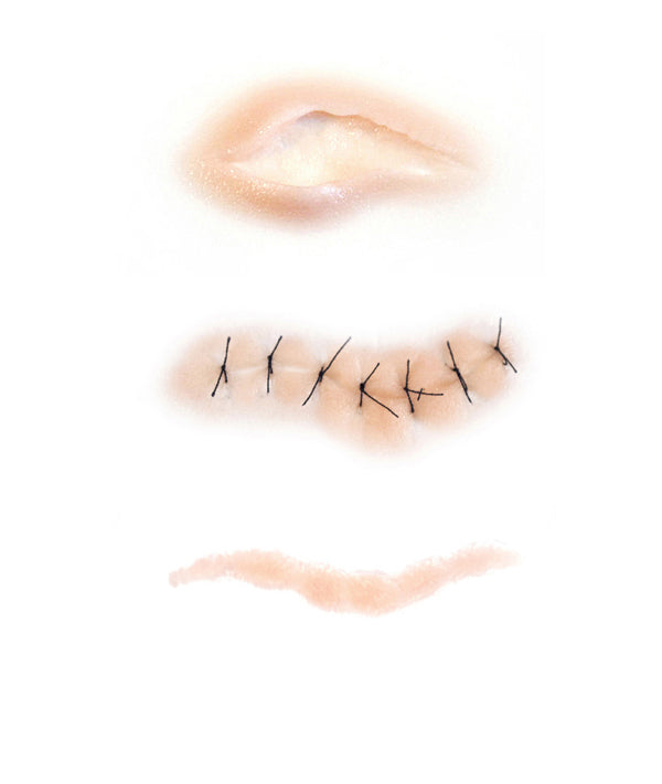 Cut-Suture-Scar Kit 1