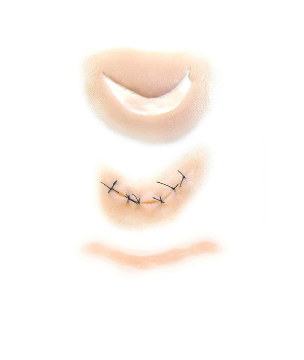 Cut-Sutured-Scar Kit 3