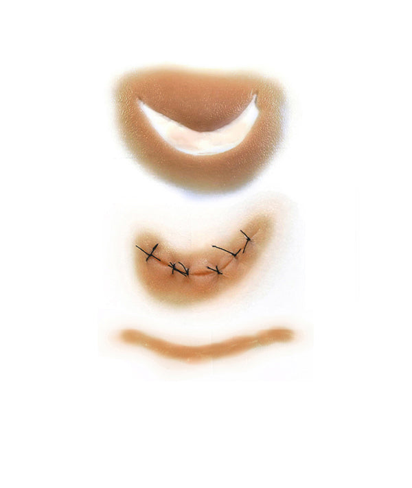 Cut-Sutured-Scar Kit 3