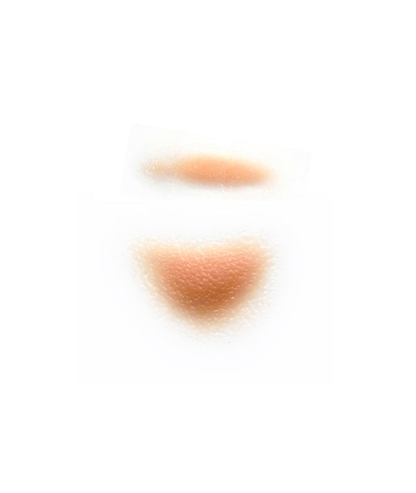 Swollen Eye Kit Left 1