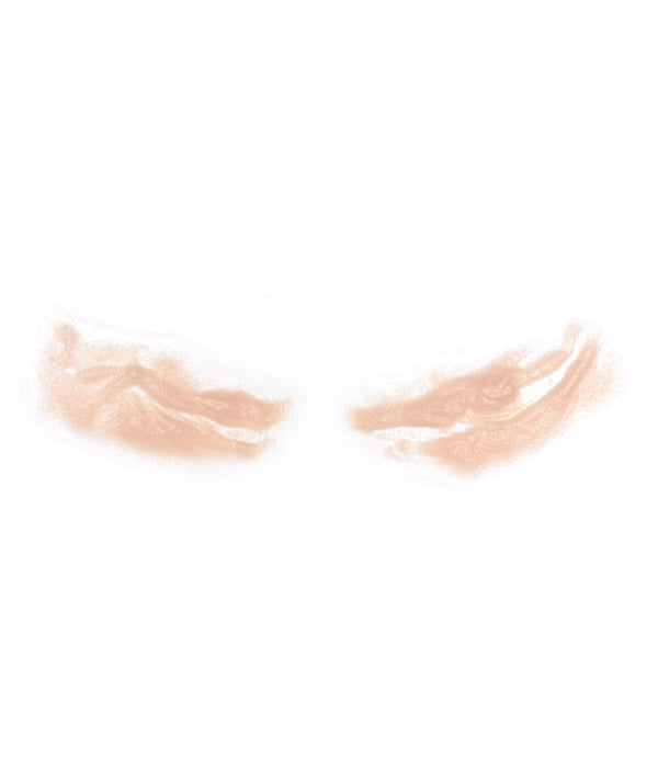 Cheek Scars
